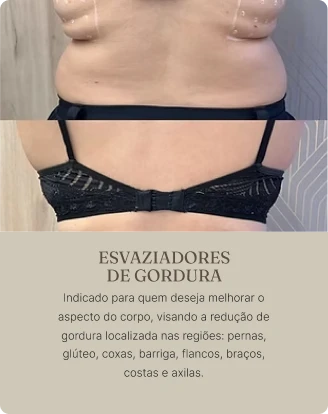 esvaziadores_de_gordura